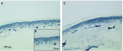 A mechanistic understanding of the relationship between skin innervation and chemotherapy-induced neuropathic pain